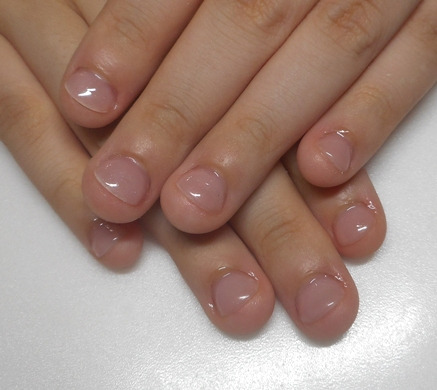 深爪矯正 成人式前撮りにそなえて深爪を改善 ハンドとフット深爪矯正サロン 下北沢ネイルサロンアリューム