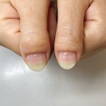 まむし爪のネイル