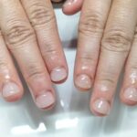 深爪矯正　ネイル　長さだし