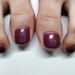 フット深爪 フット深爪矯正 長さだし